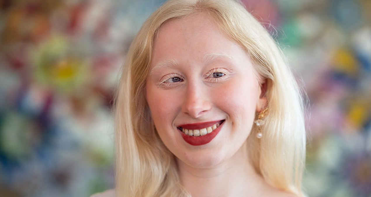 Türkiye’de sadece 3-4 bin kişide var! “‘Ay o ne öyle çok kötü’ diyen oluyor”